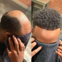 Male Hair Replacement Systems(Toupee-4C)